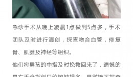 一点一点，与绞肉机争分夺秒 ;一根一根，细心接驳神经血管 | 断指再植让九岁男孩的