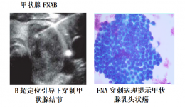 甲状腺专科介绍