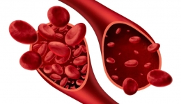 世界地贫日 | 了解地中海贫血，远离遗传病