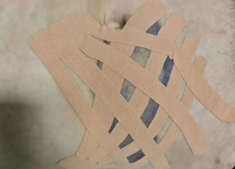 没有药物的“膏药”，带您了解肌内效贴扎技术