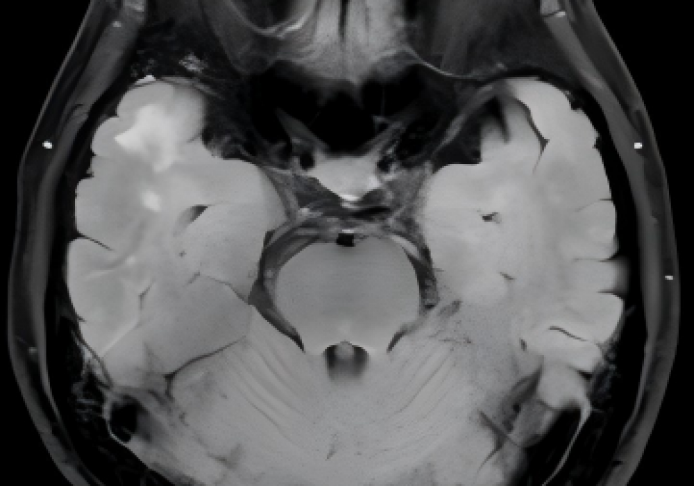 人文桂东·罕见病① | 抽丝剥茧，只为每一个生命不被辜负