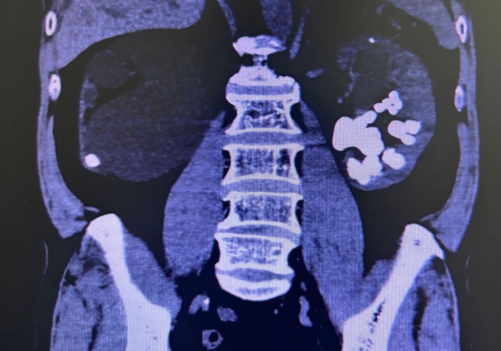 人文桂东·技术① | 精益求精，用匠心守护生命