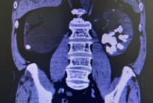 人文桂东·技术① | 精益求精，用匠心守护生命