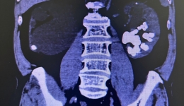 人文桂东·技术① | 精益求精，用匠心守护生命