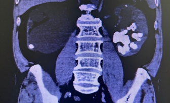 人文桂东·技术① | 精益求精，用匠心守护生命