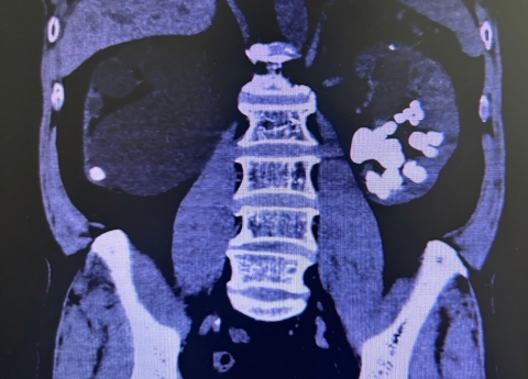 人文桂东·技术① | 精益求精，用匠心守护生命