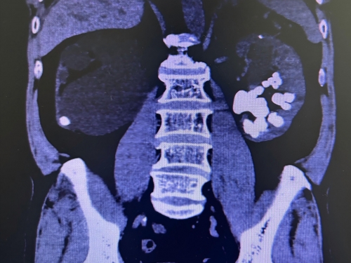 人文桂东·技术① | 精益求精，用匠心守护生命